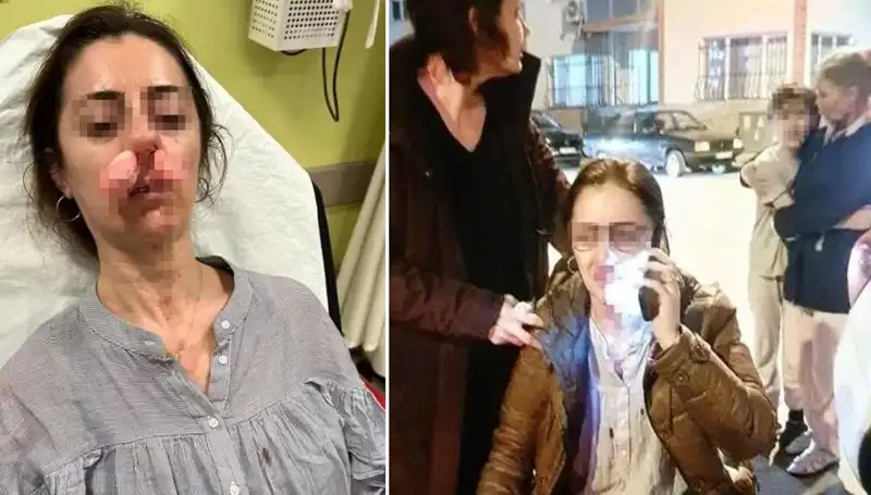 Otomobil Kapısı Silah Olarak Kullanıldı! Eşi ile Sevgiliyi Karıştıran Olay