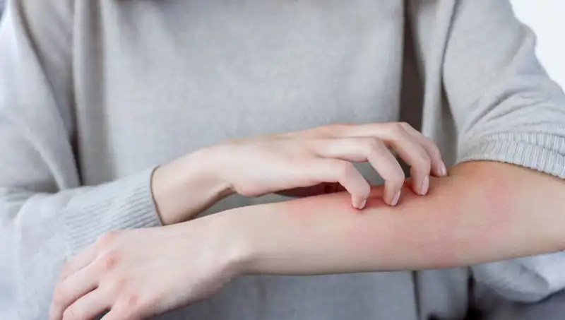 Cilt Kanseri Belirtilerini Kaçırmayın: Dermatologdan Uyarılar