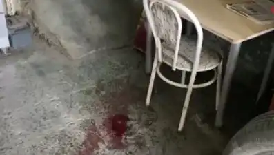 Sandalyeden Düşen Adamın Korkunç Kaza Anı ve Sonrası