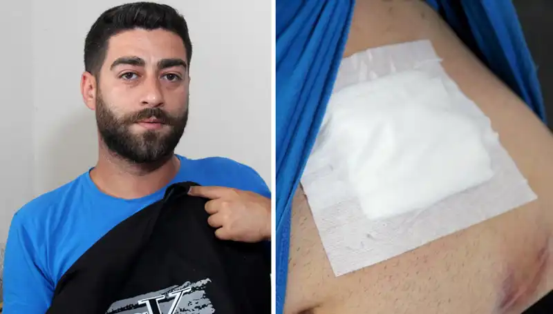 Karnındaki Ağrıya Dikkat! Röntgende Şok Edici Gerçek Ortaya Çıktı