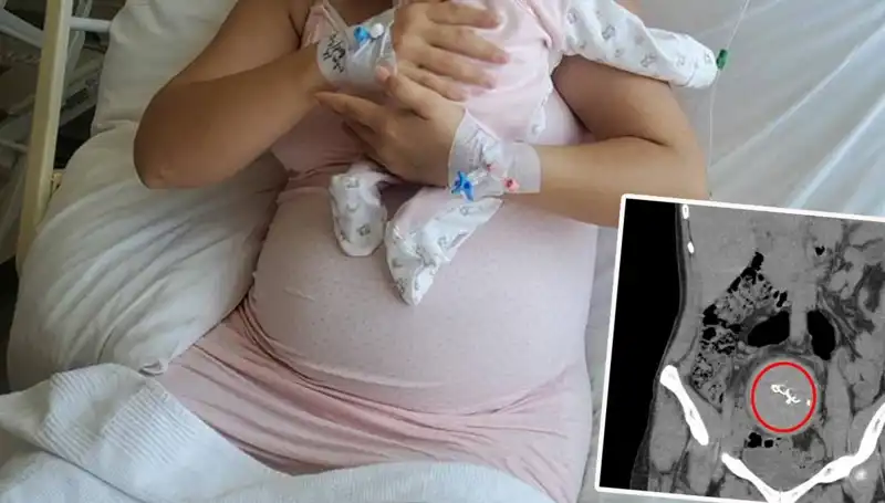 Doğumda Unutulan Bebek İki Yıl Sonra Ortaya Çıktı: Gazlı Bez İhmalinde Soruşturma