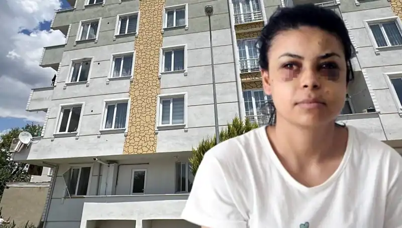 Düğünlerde Maganda Dehşeti: Saçmalar Beyin Kanaması Geçiren Genç Kızı Hedef Aldı