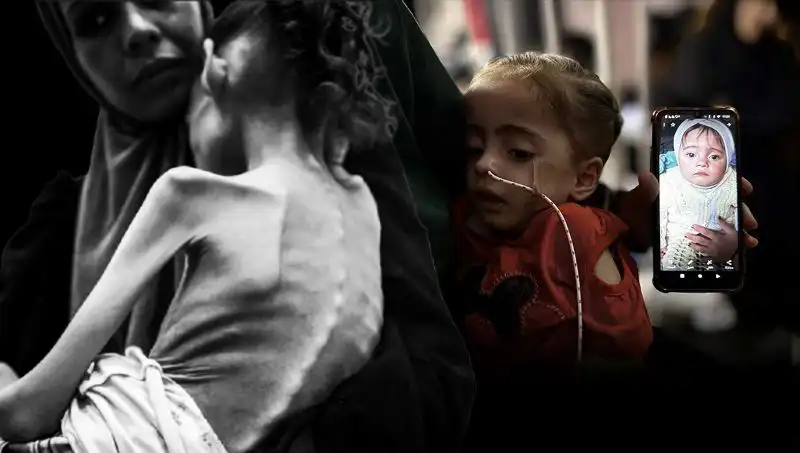 25 Kilodan 10 Kiloya Düşen Küçük Meryem’in Şaşırtan Mücadelesi