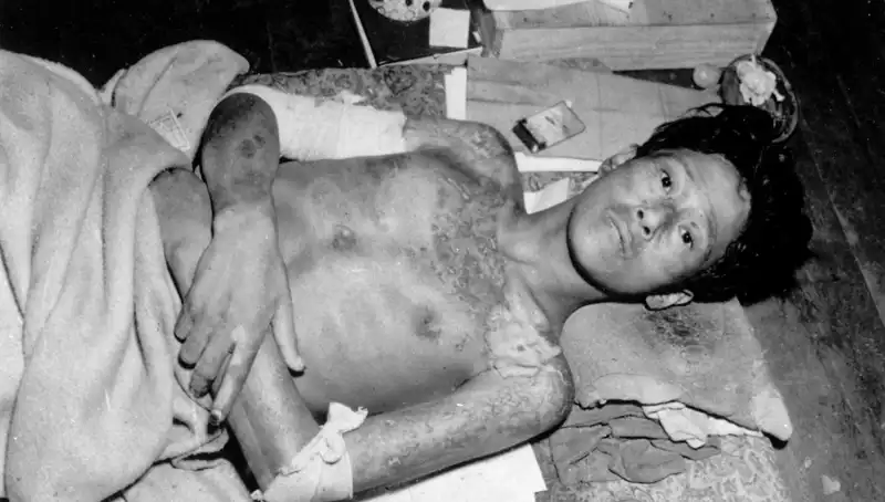 80 Yıl Sonra Nagasaki’den Çarpıcı Uyarı: Nükleer Felaket Riski Artıyor!